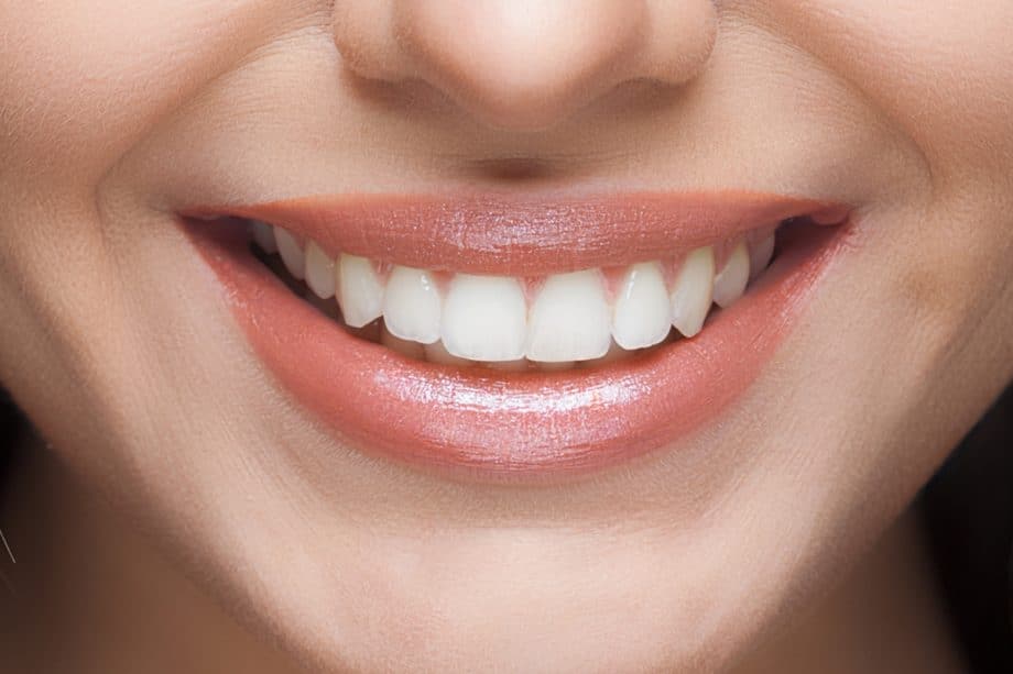 Can you whiten your teeth too much blog 920x613