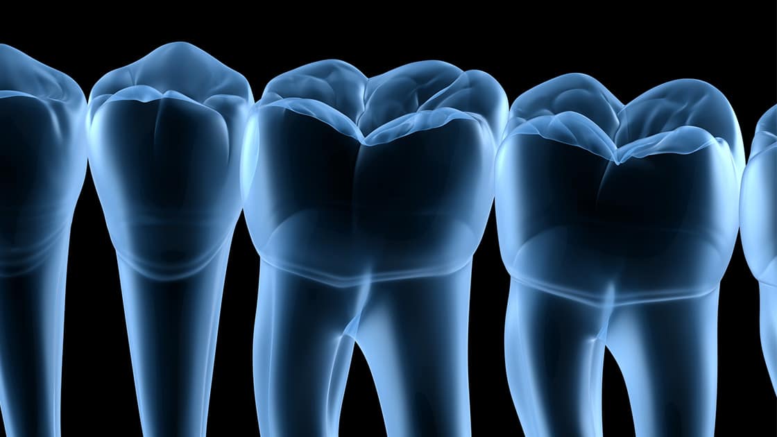 Digital teeth