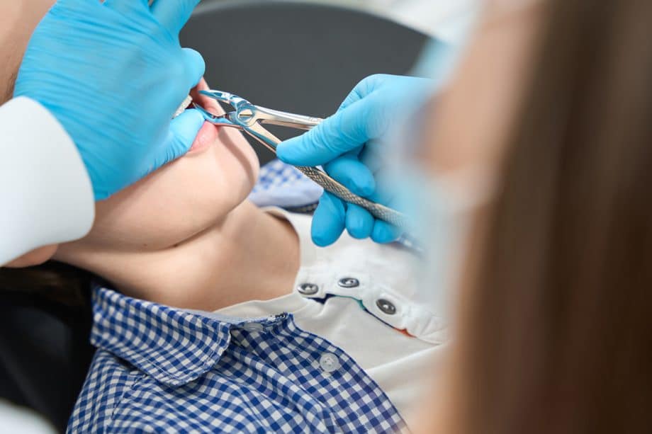 How do you stop bleeding after a tooth extraction blog 920x613