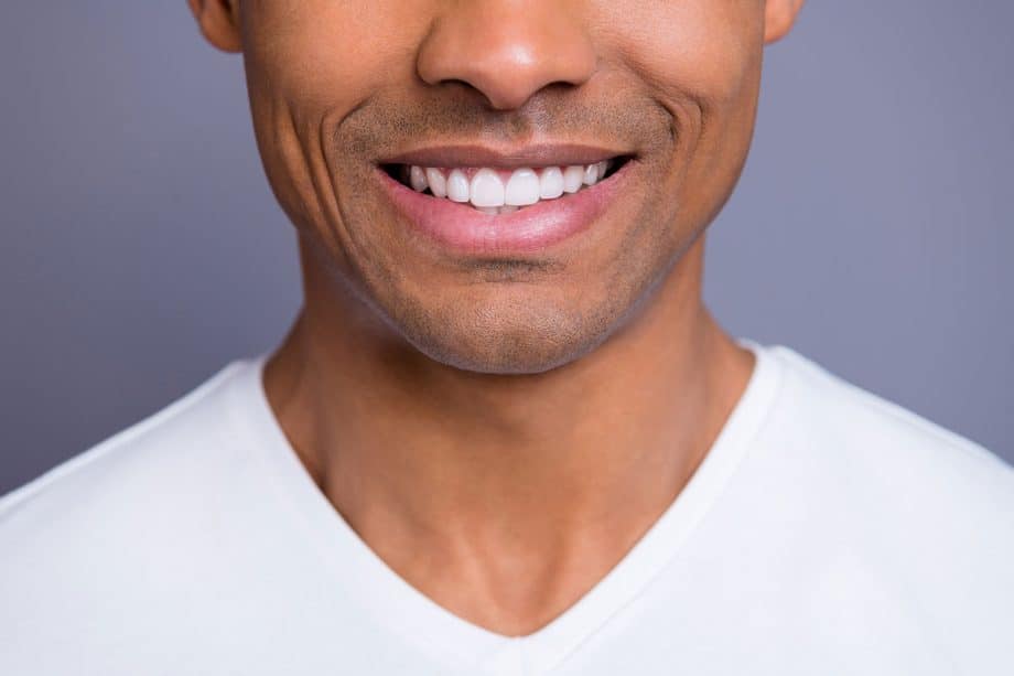 How does teeth whitening work blog 920x613