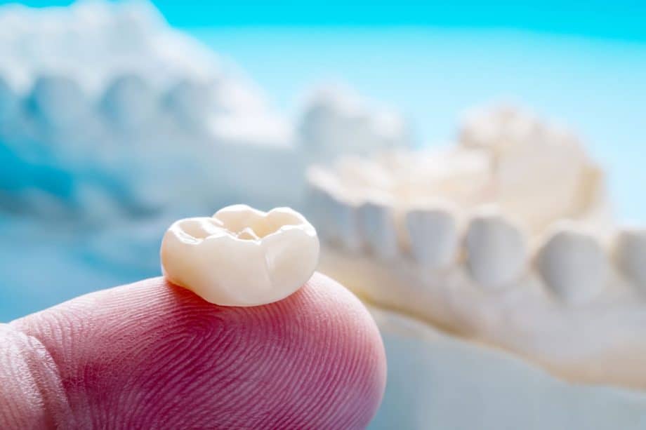 What are dental crowns made of blog 920x613