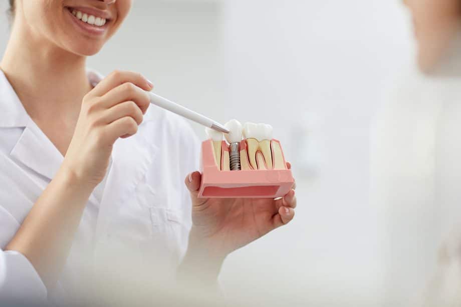 What are dental implants blog 920x613
